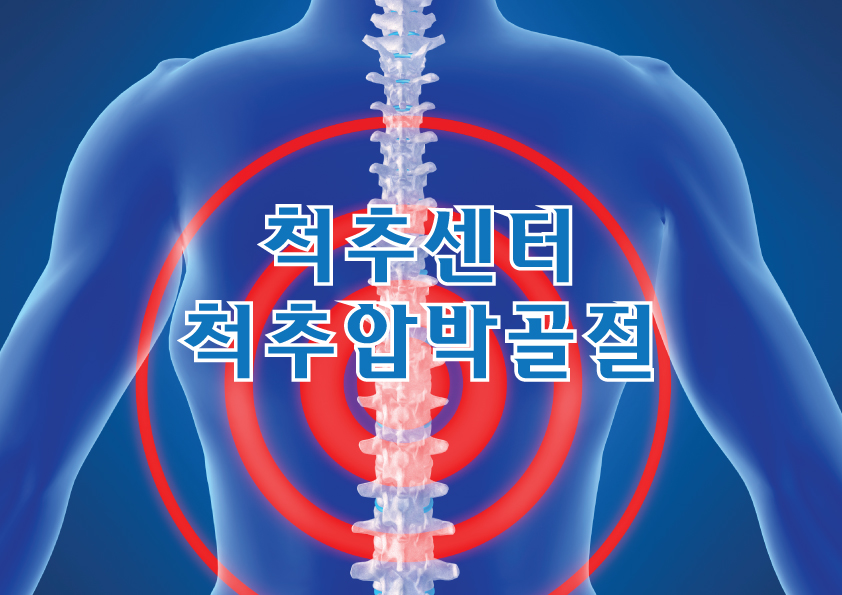 척추센터 - 척추압박골절