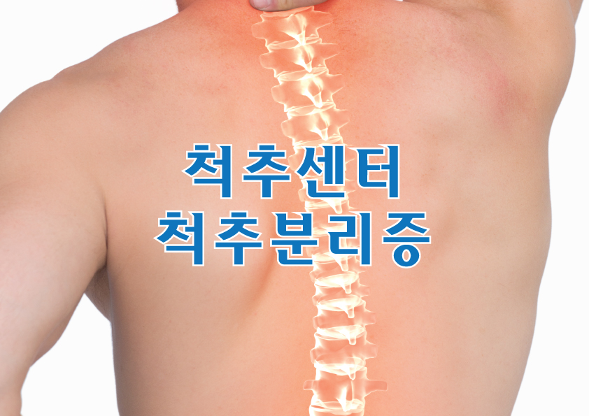 척추센터 - 척추분리증