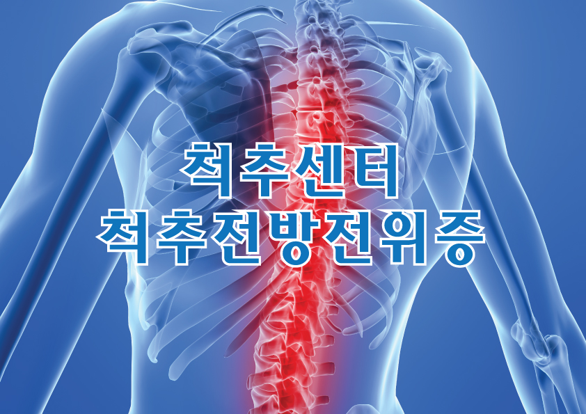 척추센터 - 척추전방전위증
