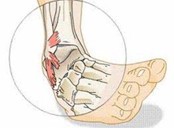 clinic-foot_sub02_img01.jpg
