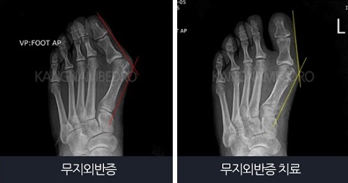 kmib_co_kr_20171201_111524.jpg