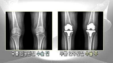 kbs_co_kr_20171201_121611.jpg